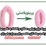 پرینوپلاستی