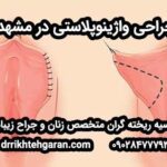 جراحی واژینوپلاستی در مشهد