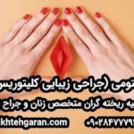 عمل هودکتومی در مشهد