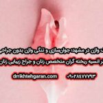 آر اف واژن در مشهد