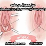 عمل پرینورافی در مشهد