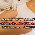 پلاسما تراپی واژن در مشهد